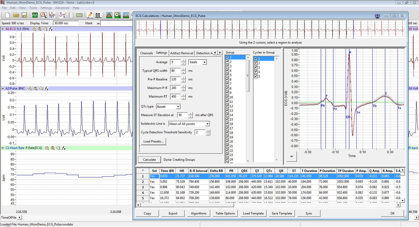 ECG Analysis Module