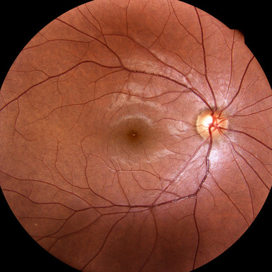 Quality Control of Retinal Pigment Epithelial Cell Therapies