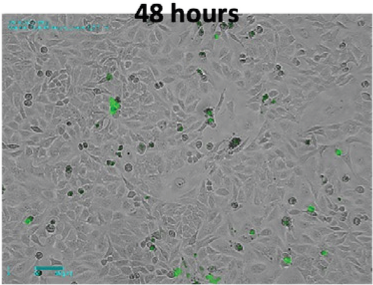 APP NOTE: Analysis of Nocodazole-Induced Cytotoxicity Using Celloger® Mini Plus