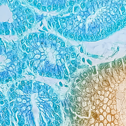 What TEER Can Tell You About Cell Culture Health