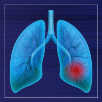 Significance of Transepithelial/ Transendothelial Electrical Resistance (TEER) Measurement in Lung In vitro Models 
