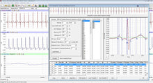 ECG Analysis Module