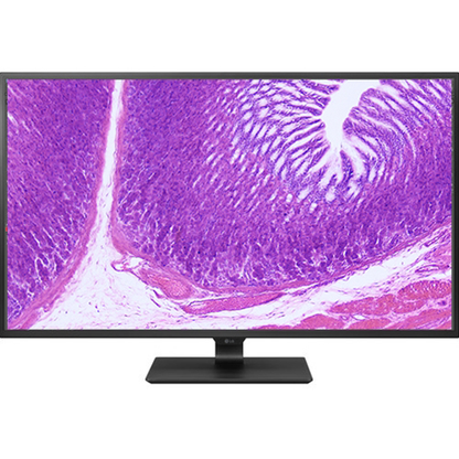 Pathology Microscope, 24" 4K Monitor, HD Camera with Analysis Software