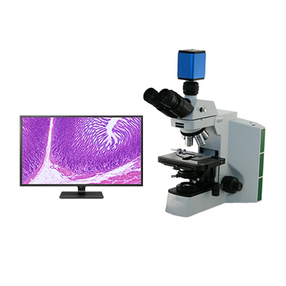 Pathology Microscope, 24" 4K Monitor, HD Camera with Analysis Software